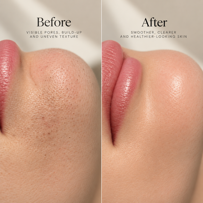 Korean Peel Shot