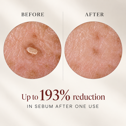 Korean Peel Shot