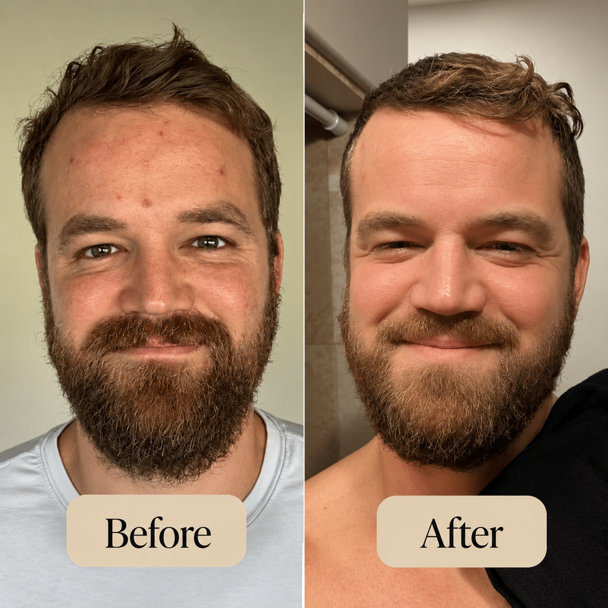 Korean Peel Shot