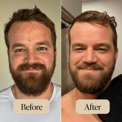 Korean Peel Shot